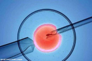42岁PGT成功案例